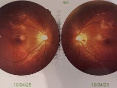 -天津大学爱尔眼科医院(天津院区)