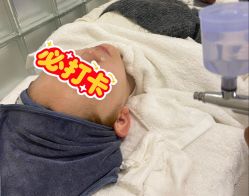 -安那般那皮肤年轻化ANAPANA