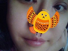 术后3天-上海华安整形外科门诊部