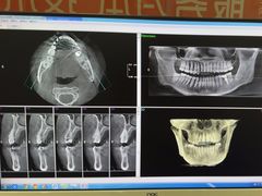 -土豆口腔(凤凰北总店)