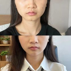 -Yestar 嘉兴艺星医疗美容医院