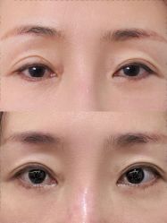 -丰联丽格医疗美容·联合丽格眼整形中心