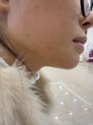 -长沙雅美医疗美容医院