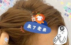 -大麦微针植发全国连锁