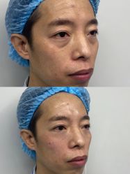 点击看大图 -广州健丽·去眼袋医疗美容机构