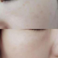-纯粹医美