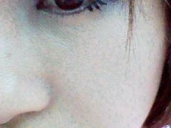 眼睛-上海华安整形外科门诊部