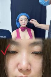-天津健丽·去眼袋医疗美容机构