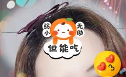 -大麦微针植发全国连锁