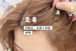 -大麦微针植发全国连锁