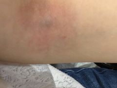 -瑞慈体检上海徐汇机构