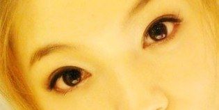 恢复了有半年的眼睛-上海华安整形外科门诊部