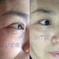 -美人痣全国连锁
