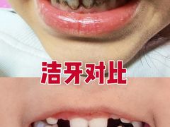 -华西牙科·四川口腔医院