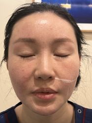 -北京米扬丽格医疗美容·联合丽格鼻整形中心