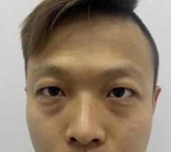-天津健丽·去眼袋医疗美容机构