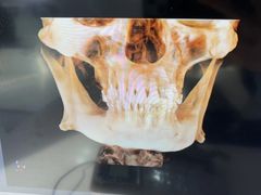 -同步齿科·数字化正畸种植口腔中心(珠海店)