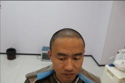 -大麦微针植发丨全国连锁
