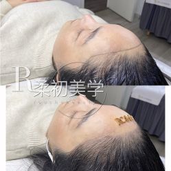 -RC半永久纹眉纹发际线