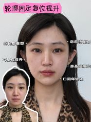-Yestar重庆艺星医疗美容医院