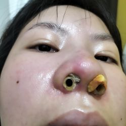 点击看大图 -厦门美莱整形美容医院