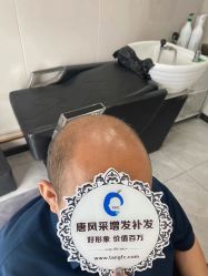 -唐风采假发补发定制