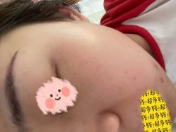 体验前-坤如玛丽·医疗美容中心