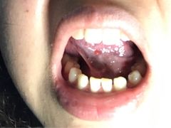-同步齿科·数字化正畸种植口腔中心(前山店)