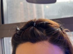 -碧莲盛·不剃发植发