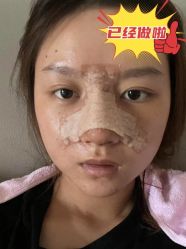-素美医疗美容·西南眼鼻整形·修复基地