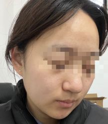 体验后-Dr.U博士医疗美容医院