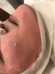点击看大图 -悦己医疗美容整形线雕提升专门店