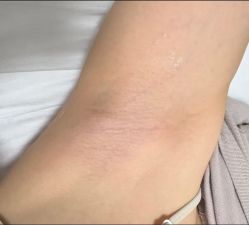 -杭州医巢医疗美容