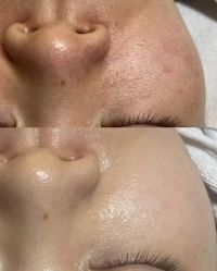 点击看大图 -栖SPA·ONDA ·海菲秀·皑皑科技美肤中心
