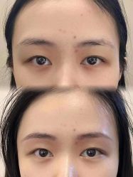 -张小野·专业半永久纹眉
