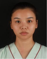 体验前-北京米扬丽格医疗美容·联合丽格鼻整形中心