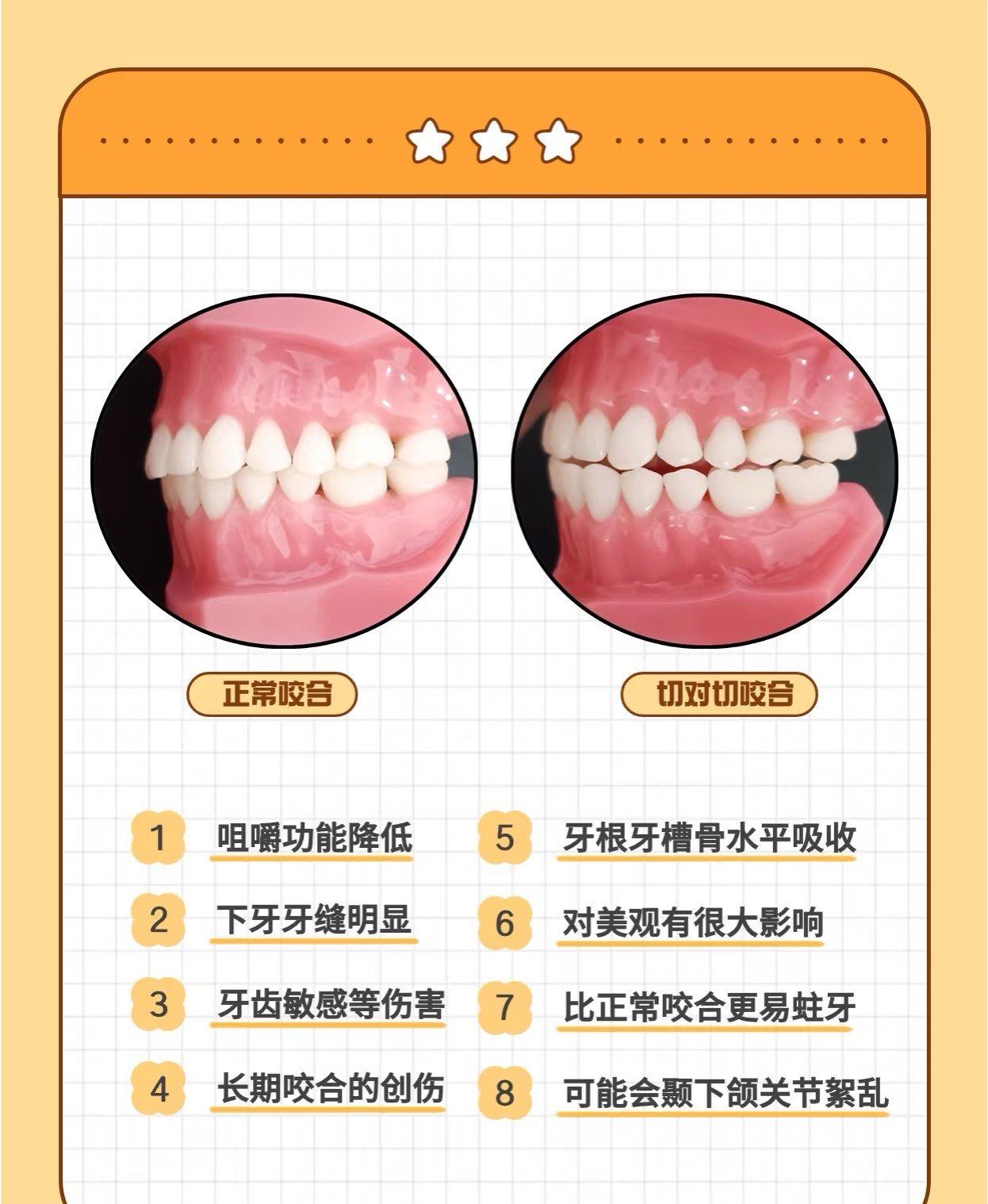 n我们正常牙齿咬合不管是前牙,还是后牙,都有一个正常的覆颌覆盖