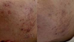 -蕾特恩专业祛痘·皮肤管理