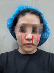 体验前-深圳阳光医疗美容医院·旗舰店