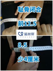 -蓝丝带产后恢复中心(都江堰店)