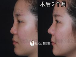 -北京米扬丽格医疗美容·联合丽格鼻整形中心
