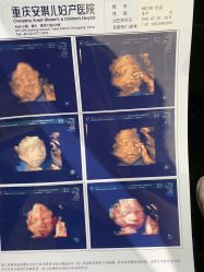 点击看大图 -重庆安琪儿妇产医院-妇幼保健联盟医院