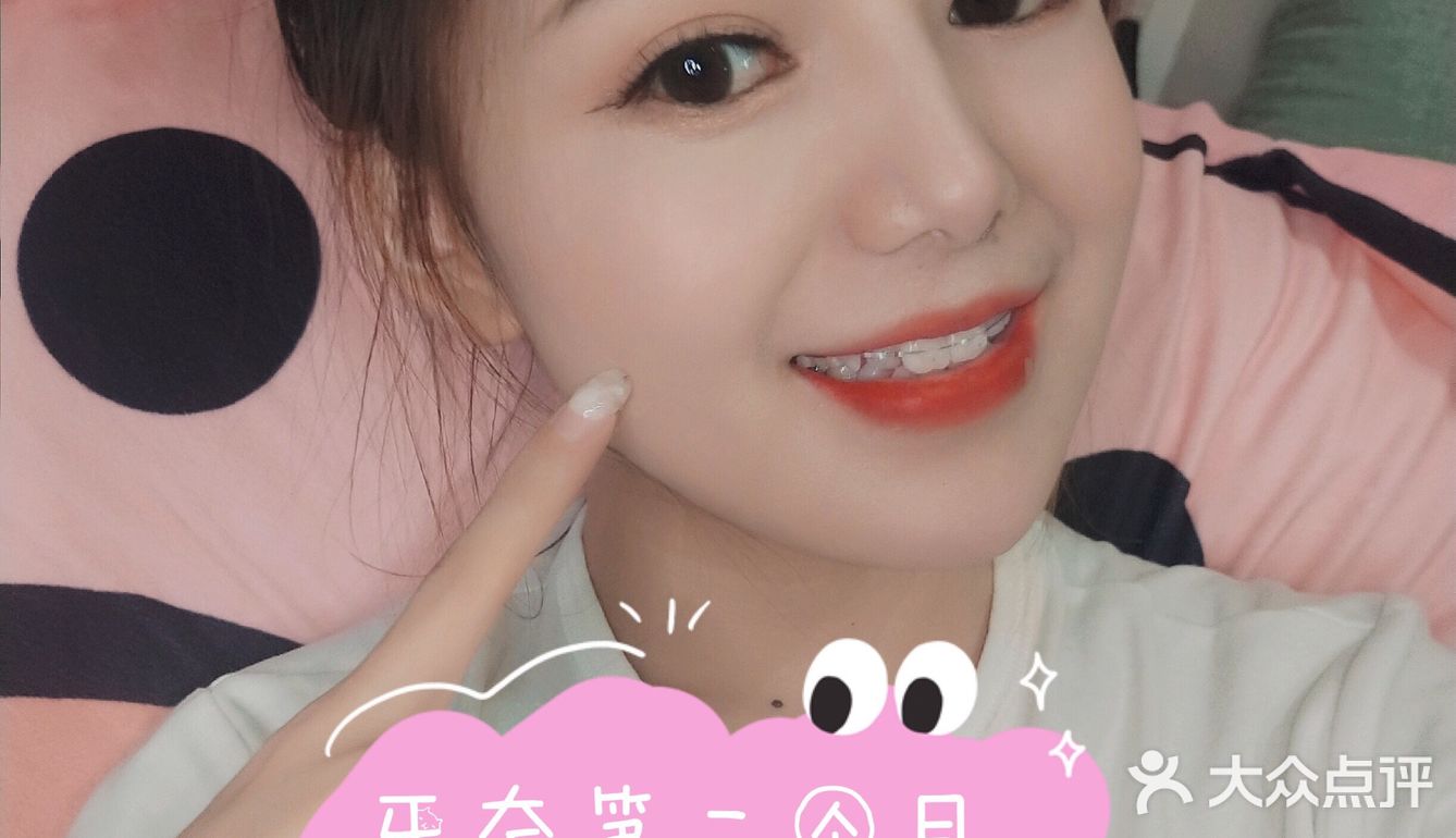 牙齿矫正案例 虎牙小美女逆袭日记