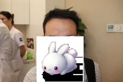 -大麦微针植发丨全国连锁