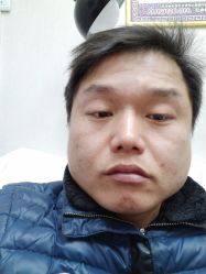 -北京美痣堂古方祛痣斑疣瘊