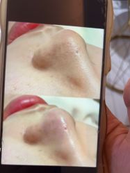 -苑苑vbeauty科技美容SPA