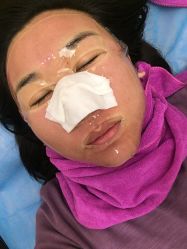 -北京米扬丽格医疗美容·联合丽格鼻整形中心