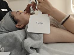 -skin79皮肤管理中心