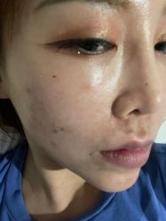 -More摩尔医美の注射线雕光电中心