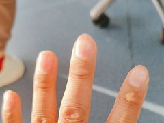 -新甲连锁灰指甲·甲沟炎·修脚(爱联店)